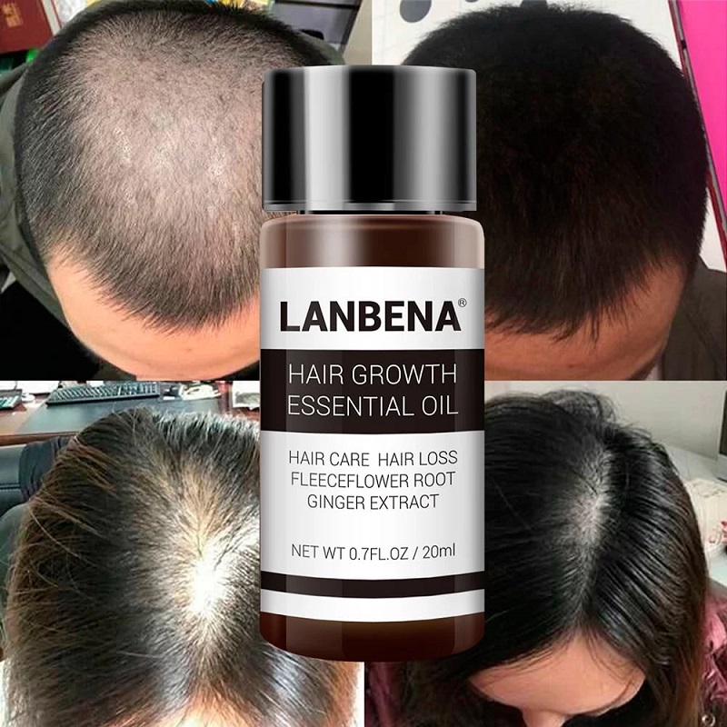 روغن رشد مو و ریش لانبنا LANBENA