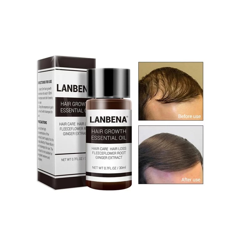 روغن رشد مو لانبنا LANBENA